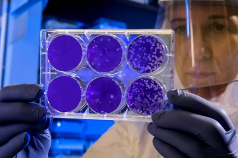 Wabah Virus Marburg Muncul di Afrika, 9 Meninggal dan Ratusan Orang Dikarantina