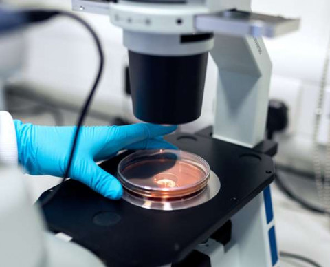 WHO: Jangan Sampai Superbug Jadi Silent Pandemi Selanjutnya!
