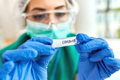 Varian Baru Covid-19 LB.1 Terdeteksi di Australia dan AS, Lebih Cepat Menular