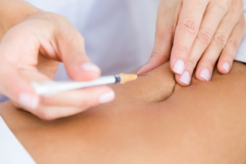 Hilangkan Lemak dengan Liposuction