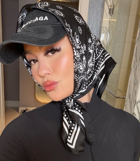 Ternyata Agnez Mo Memiliki Penyakit Autoimun dan Sebabkan Alopecia, Penyakit Apa Itu?