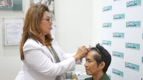 Retouch Hair Transplant, Perbaiki Hasil Transplantasi yang Kurang Sesuai Ekspektasi