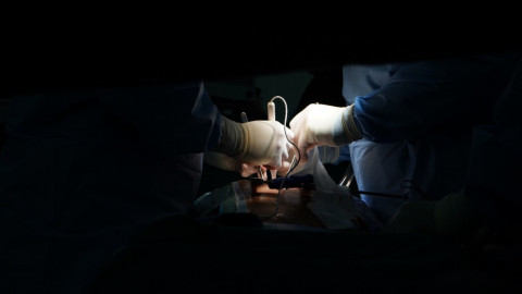 Mengenal Diseksi Aorta dalam Jantung, Apakah Bisa Berhasil Dioperasi?