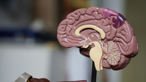Kenali FAST Si Gejala Stroke dan Segera Bawa ke Rumah Sakit Siaga Stroke