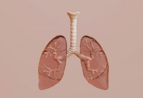 Alarm Keras TBC di Jabar! Sebanyak 81 Ribu Kasus TBC Terungkap