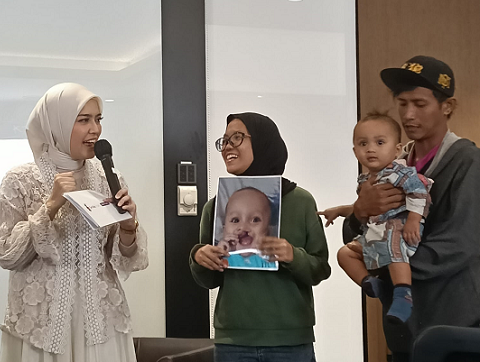 Operasi Gratis dan Perawatan Komprehensif Ahli: Jawab Stigma Negatif Bibir Sumbing