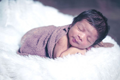 Pusar Bayi Merah & Benjol? Kenalin Granuloma Umbilikal!