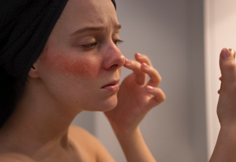 8 Kandungan Skincare untuk Perbaiki Skin Barrier yang Rusak