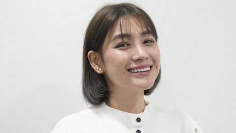 Veneer Gigi Gaya Baru: Lebih Natural ala Korean Look, Fix Bikin Senyum Makin Manis!