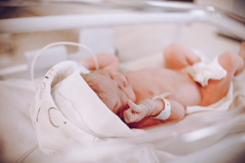 Newborn Health Guide! Memahami Penyebab & Fakta di Balik Bayi Kuning
