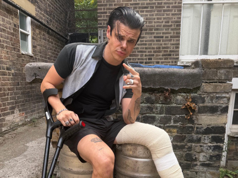 Yungblud Patah Kaki Akibat Kecelakaan Motor, Tetap Lanjut Tur Konser