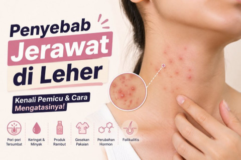 Penyebab Jerawat di Leher, Kenapa Bisa Muncul?