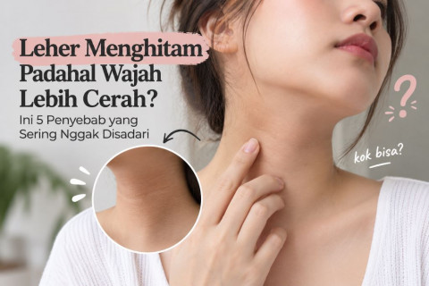 Plot Twist Leher Gelap: Ternyata Bukan Cuma Daki, tapi Gara-gara 5 Hal Ini