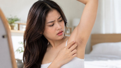 Ketiak Makin Gelap? Bisa Jadi 5 Kebiasaan Ini Penyebabnya