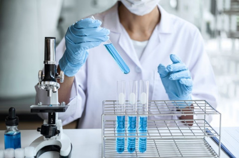 5 Hal yang Wajib Kamu Tahu soal Pes Pneumonia di Rusia