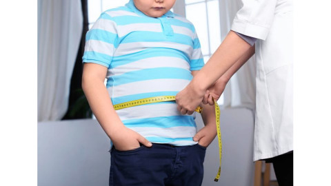 Begini 4 Cara Mengatasi Obesitas pada Anak