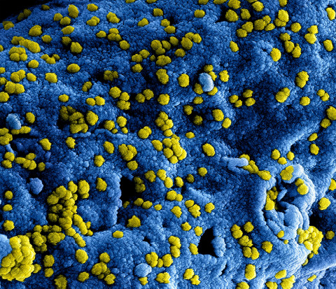 Catat! Peneliti BRIN Bagikan Tips Agar Tak Tertular Virus HMPV