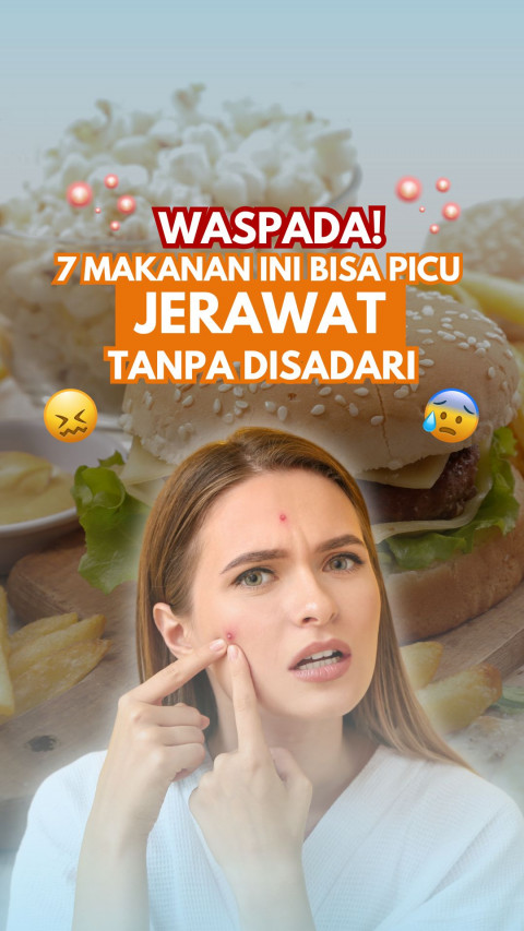 Waspada! 7 Makanan Ini Bisa Picu Jerawat Tanpa Disadari