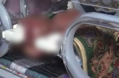 Bayi Prematur Ini Hebohkan Warga Kolaka Timur