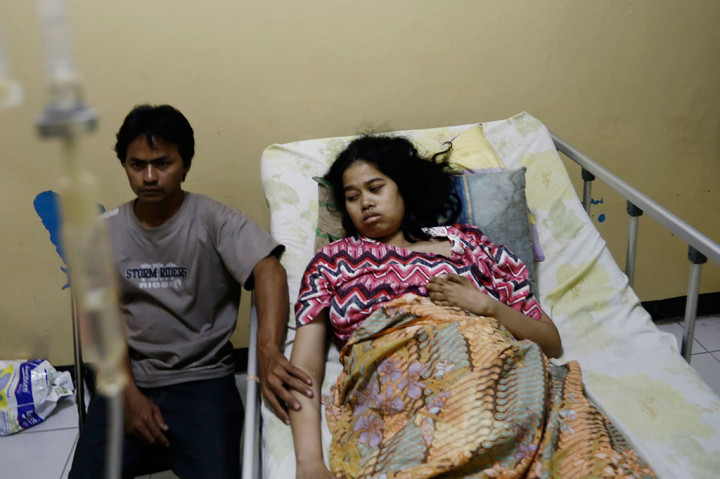 Tati, TKI Korban Kekerasan Majikan Alami Kelumpuhan 