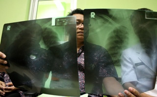 Menko Kesra: Tingkatkan Kewaspadaan Virus MERS