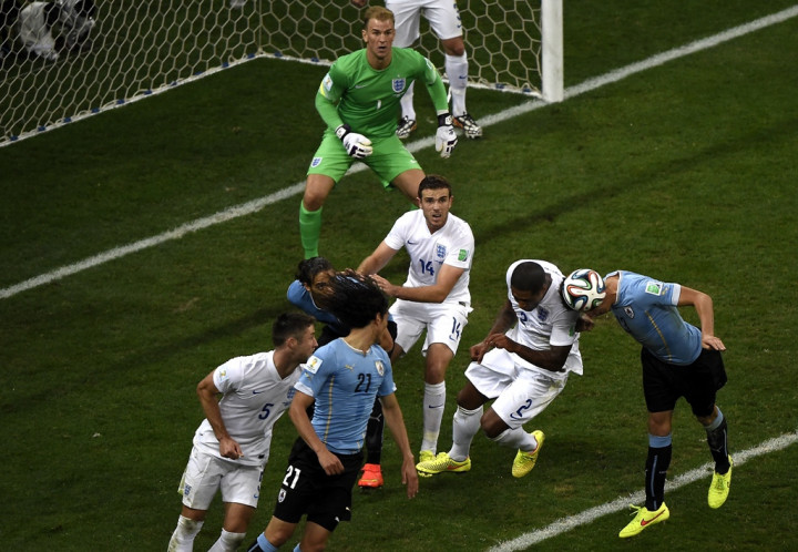 Ferdinand: Pertahanan Inggris Memprihatinkan