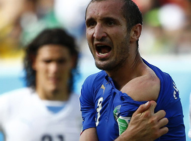 Lugano Sebut Chiellini Berlebihan Terkait Gigitan Suarez