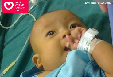 Kenali Atresia Bilier, Penyakit yang Diidap 1 dari 10 Ribu Bayi