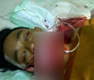 Diduga Dikeroyok Teman, Audi Tewas dengan Luka Bacokan 