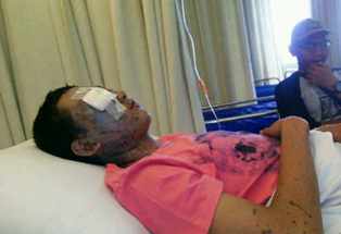 Polisi Kirim Surat Panggilan terhadap Siswa Penyiram Air Keras