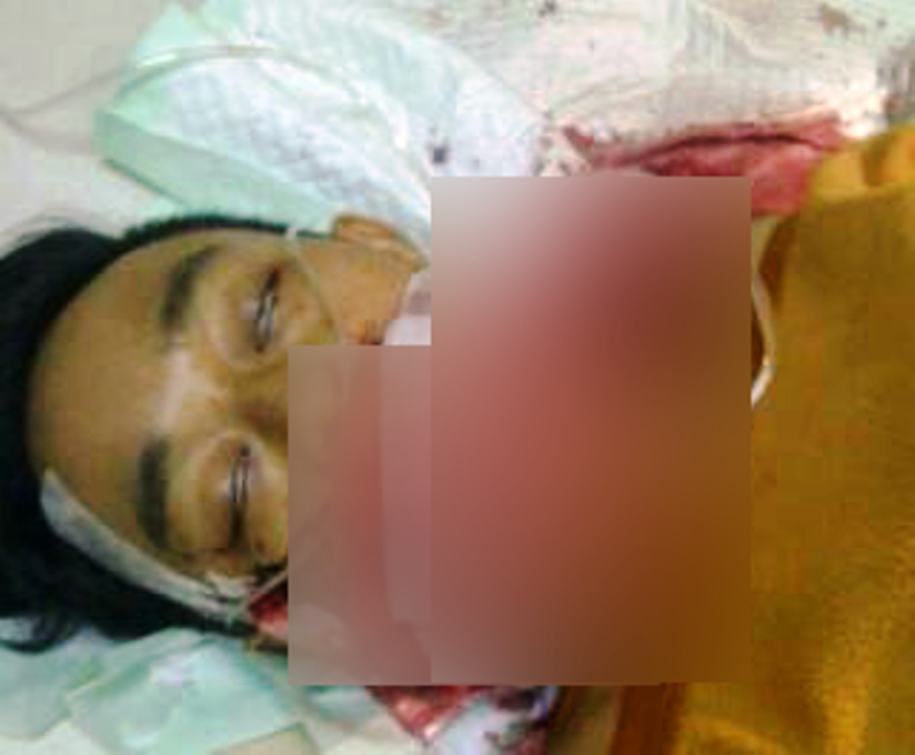 Kondisi terakhir Audi sebelum tutup usia akibat luka-luka yang dideritanya--foto: dok.keluarga 