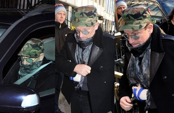 Bono Rayakan Natal dengan Tangan Diperban