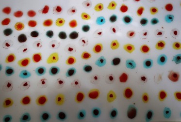 Kaum Homoseksual di AS kini Boleh Donorkan Darah