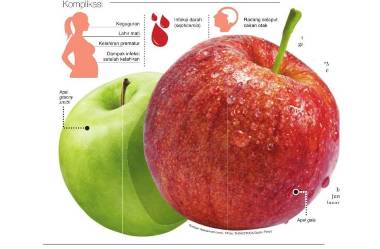 Apel AS yang Diduga Tercemar Listeria masih Dijual di Indonesia 