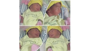 Bayi Tabung Kembar Empat Lahir Selamat di Yogyakarta