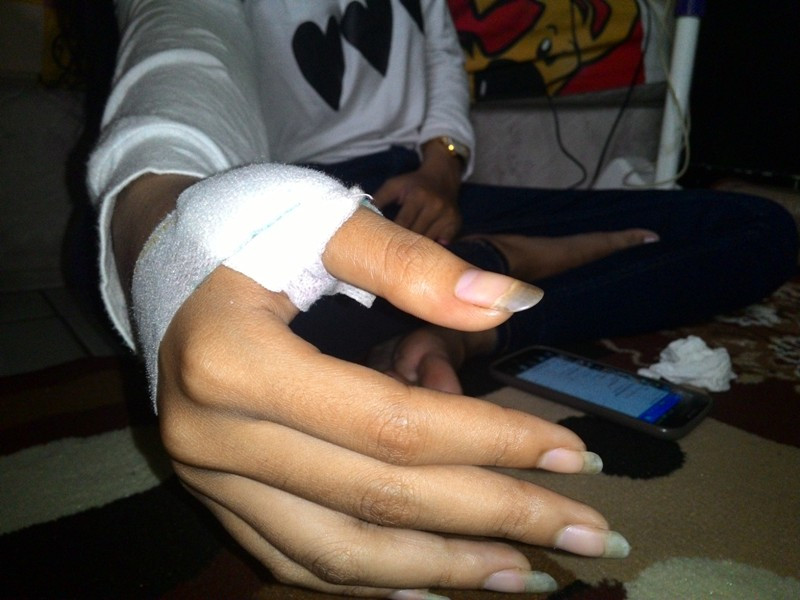 Tangan korban begal di Pondok Aren terluka setelah menahan sabetan samurai pelaku. MTVN/Arga