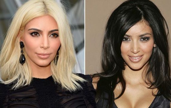 Rahasia Cantik Kim Kardashian: Operasi Plastik