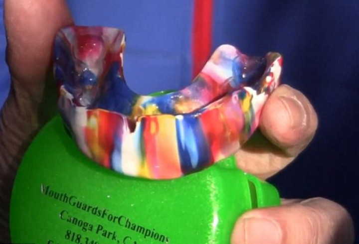 Giliran Pacquiao yang Pamer Pelindung Gigi