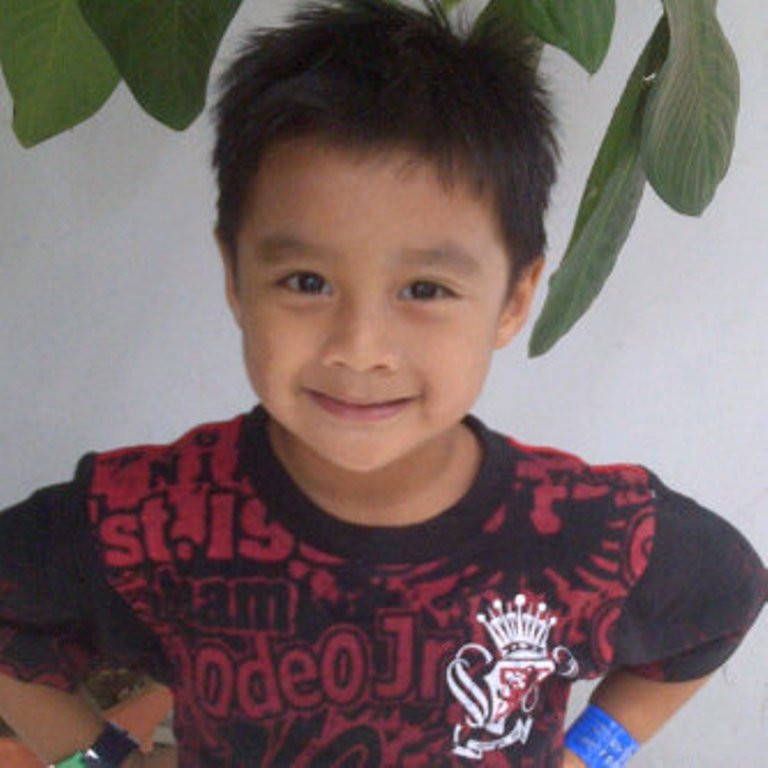 Taufik, korban tabrak lari Patwal di Cirebon, yang selamat. Foto: Istimewa