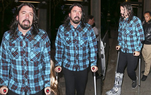 Dave Grohl Berjalan Dibantu Tongkat