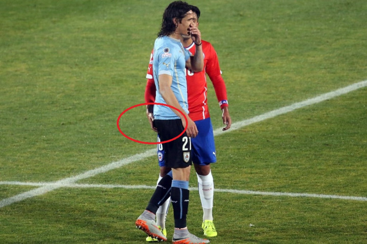 Aksi Colek Bokong Cavani, Jara Bisa Dihukum Berat