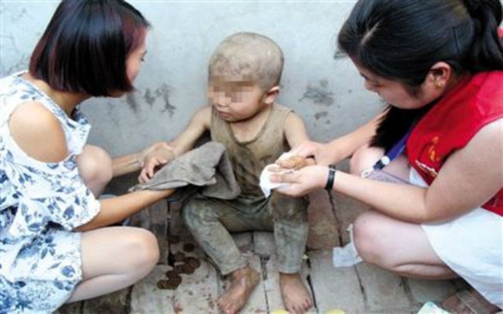 Hongbo saat dirawat relawan (Foto: Puyang Morning Post)