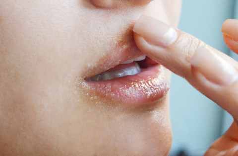 cara mengecilkan bibir