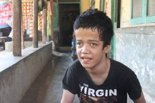 19 Tahun Menderita Hydrocephalus, Suwendo Butuh Uluran Tangan