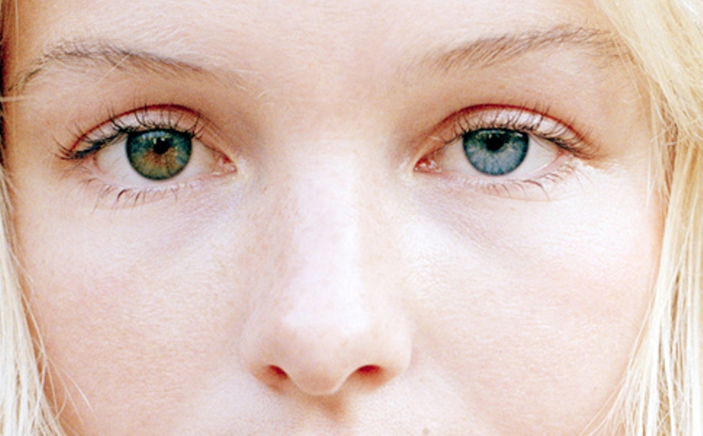 Другой голубой. Цветные линзы гетерохромия. Гетерохромия глаз Элизабет. Виола гетерохромия. Глаза вампира гетерохромия.