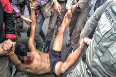 Ayah: Walkot Jaktim Janji Tanggung Biaya Pengobatan Eko Hingga Sembuh