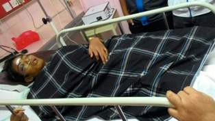 Eko, Korban Bulan-bulanan Satpol PP Belum Bisa Bicara