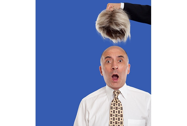 5 Cara Mengatasi Kebotakan