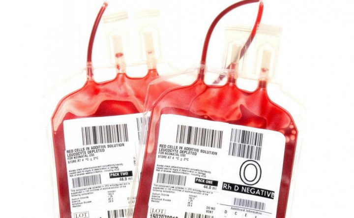 Pemilik Darah Rhesus Negatif Tidak Boleh Sering Donor Darah