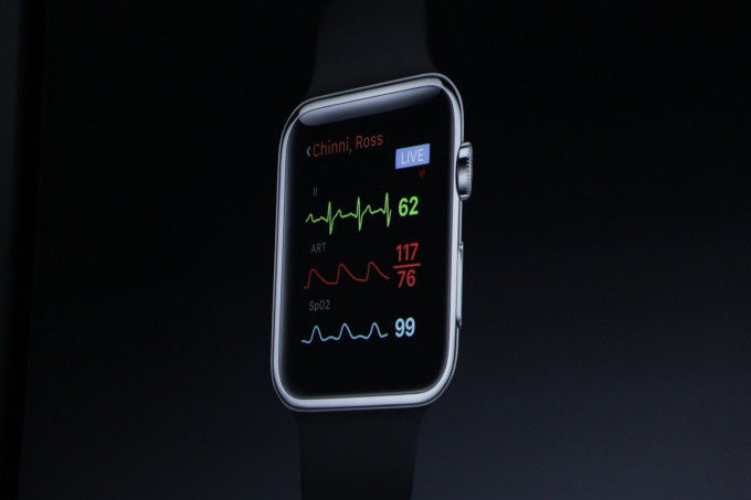 Ibu Hamil Bisa Pakai Apple Watch untuk Mengukur Detak Jantung Janin